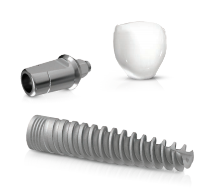 Dental implants